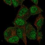 CENTG1 Polyclonal Antibody