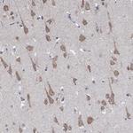 CENTG1 Antibody in Immunohistochemistry (Paraffin) (IHC (P))