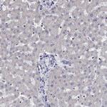 CENTG1 Antibody in Immunohistochemistry (Paraffin) (IHC (P))