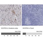 SCCPDH Polyclonal Antibody