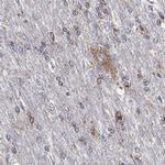 SCCPDH Antibody in Immunohistochemistry (Paraffin) (IHC (P))