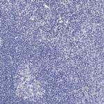 SCCPDH Antibody in Immunohistochemistry (Paraffin) (IHC (P))