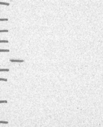 SCCPDH Antibody in Western Blot (WB)