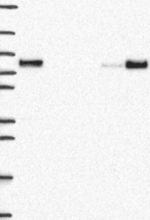 MTHFR Antibody in Western Blot (WB)