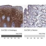 SULT2B1 Polyclonal Antibody
