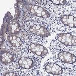 SULT2B1 Antibody in Immunohistochemistry (Paraffin) (IHC (P))