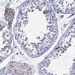 TSPAN16 Antibody in Immunohistochemistry (Paraffin) (IHC (P))