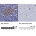 RGS13 Polyclonal Antibody