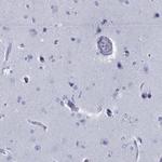 RGS13 Antibody in Immunohistochemistry (Paraffin) (IHC (P))
