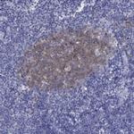 RGS13 Antibody in Immunohistochemistry (Paraffin) (IHC (P))