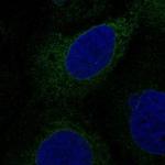 TMEM97 Polyclonal Antibody