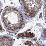 TMEM97 Antibody in Immunohistochemistry (Paraffin) (IHC (P))