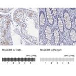 MAGEB6 Polyclonal Antibody