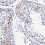 MAGEB6 Antibody in Immunohistochemistry (Paraffin) (IHC (P))