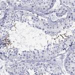 SH2D7 Antibody in Immunohistochemistry (Paraffin) (IHC (P))