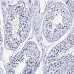EPX Antibody in Immunohistochemistry (Paraffin) (IHC (P))