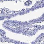SMCP Antibody in Immunohistochemistry (Paraffin) (IHC (P))
