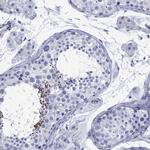 SMCP Antibody in Immunohistochemistry (Paraffin) (IHC (P))