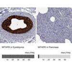 MTHFR Polyclonal Antibody