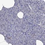 MTHFR Antibody in Immunohistochemistry (Paraffin) (IHC (P))