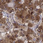 MTHFR Antibody in Immunohistochemistry (Paraffin) (IHC (P))