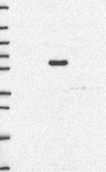 MTHFR Antibody in Western Blot (WB)