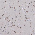 LRFN4 Antibody in Immunohistochemistry (Paraffin) (IHC (P))