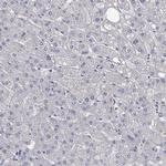 LRFN4 Antibody in Immunohistochemistry (Paraffin) (IHC (P))