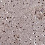CLSTN1 Antibody in Immunohistochemistry (Paraffin) (IHC (P))