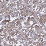 CMYA5 Antibody in Immunohistochemistry (Paraffin) (IHC (P))