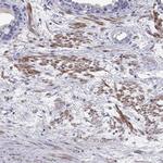 CMYA5 Antibody in Immunohistochemistry (Paraffin) (IHC (P))