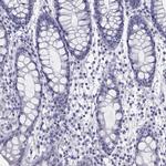 CMYA5 Antibody in Immunohistochemistry (Paraffin) (IHC (P))