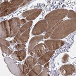 CMYA5 Antibody in Immunohistochemistry (Paraffin) (IHC (P))