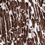 MGST3 Antibody in Immunohistochemistry (Paraffin) (IHC (P))