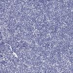 MGST3 Antibody in Immunohistochemistry (Paraffin) (IHC (P))