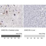 ANKS1B Polyclonal Antibody