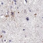 ANKS1B Antibody in Immunohistochemistry (Paraffin) (IHC (P))