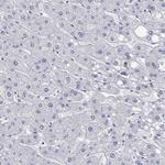 ANKS1B Antibody in Immunohistochemistry (Paraffin) (IHC (P))