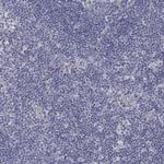 ANO7 Antibody in Immunohistochemistry (Paraffin) (IHC (P))