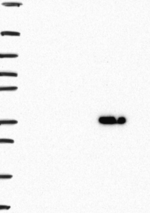 GRHPR Antibody in Western Blot (WB)