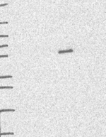 SHMT1 Antibody in Western Blot (WB)