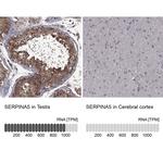 SERPINA5 Polyclonal Antibody