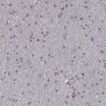 SERPINA5 Antibody in Immunohistochemistry (Paraffin) (IHC (P))