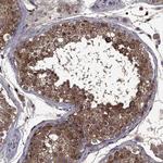 SERPINA5 Antibody in Immunohistochemistry (Paraffin) (IHC (P))