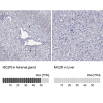 MC2R Polyclonal Antibody