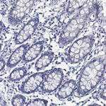 MC2R Antibody in Immunohistochemistry (Paraffin) (IHC (P))