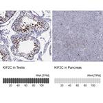 MCAK Antibody in Immunohistochemistry (Paraffin) (IHC (P))
