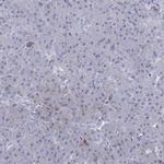 MCAK Antibody in Immunohistochemistry (Paraffin) (IHC (P))