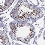 MCAK Antibody in Immunohistochemistry (Paraffin) (IHC (P))