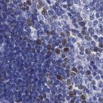 MCAK Antibody in Immunohistochemistry (Paraffin) (IHC (P))